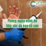 Phòng ngừa viêm da tiếp xúc do keo và sơn
